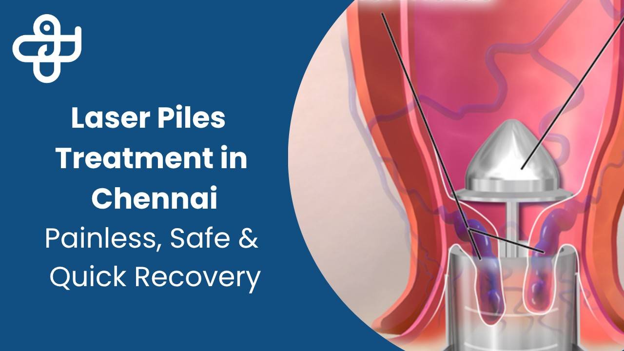 Laser Piles Treatment