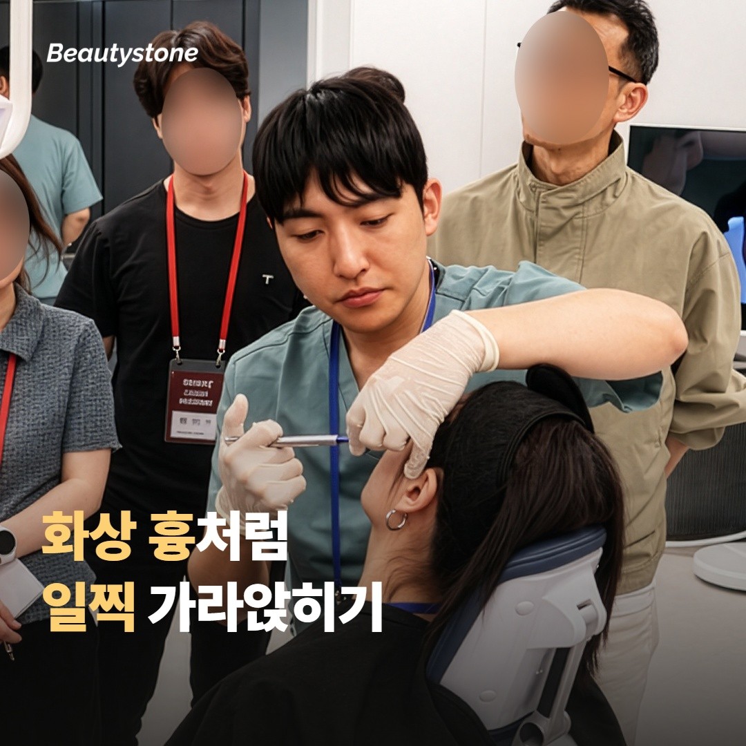 화상 흉을 줄이는 것과 같은 원리예요