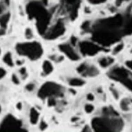 Image of a DEXA scan