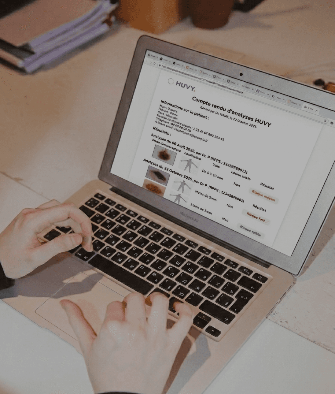 Capture d'écran du compte rendu envoyé sur l'adresse mail du patient