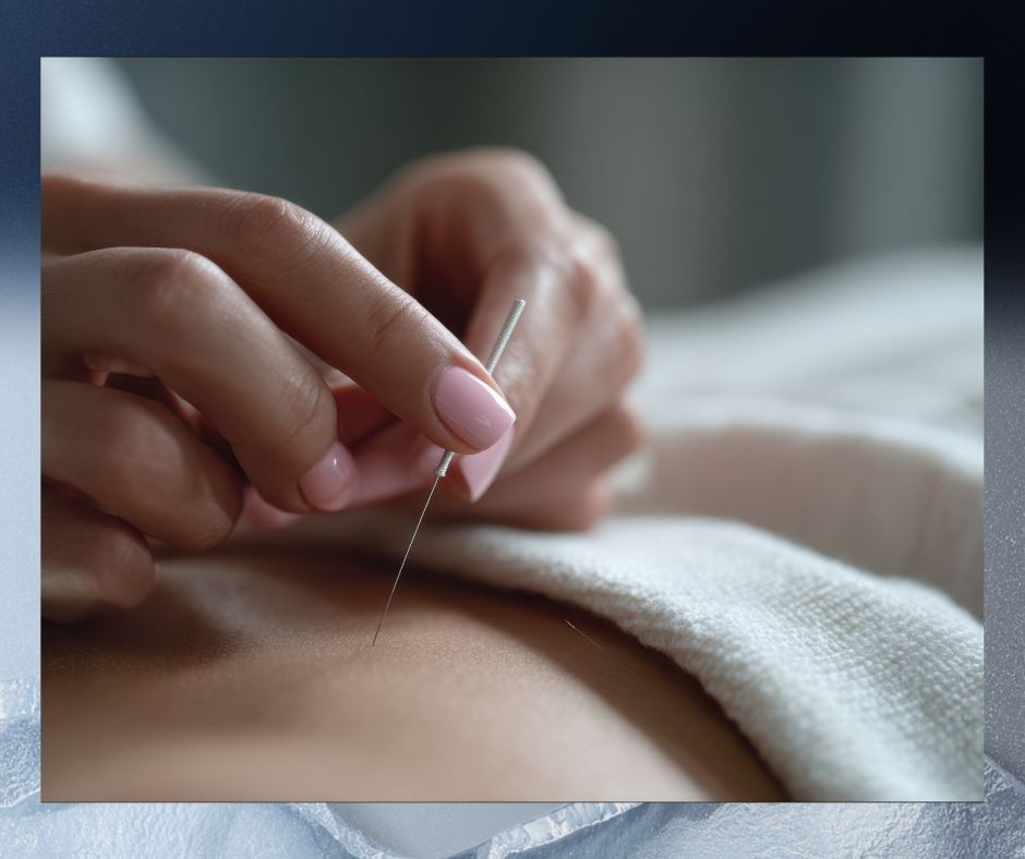 image d'un traitement d'acupuncture, 2 mains, une aiguille sur un dos