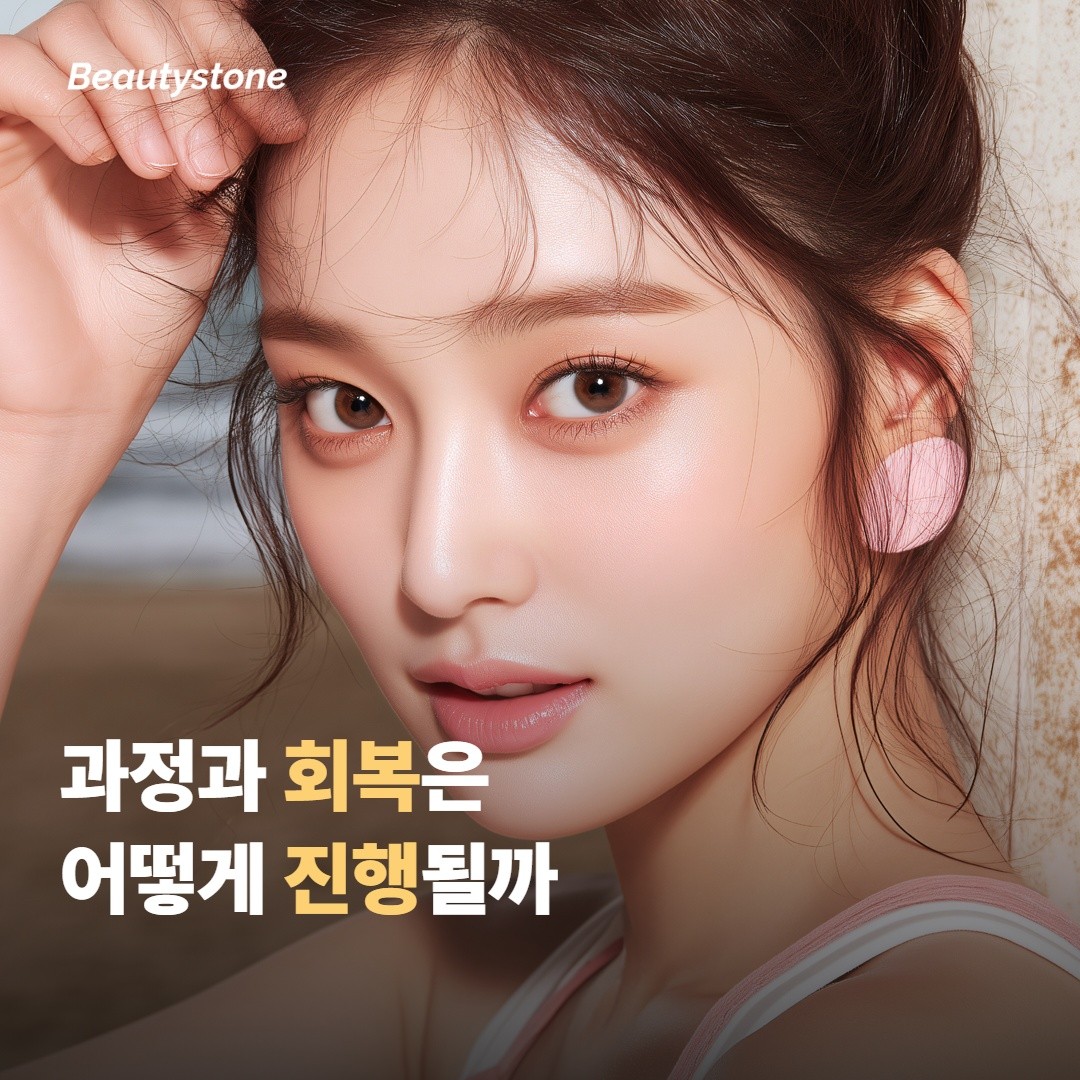 시술 과정과 회복은 어떻게 진행될까요