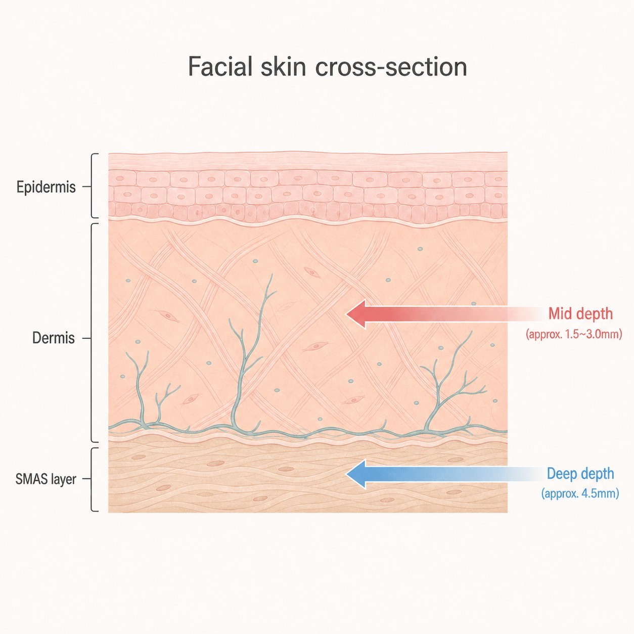 The dermis Thermage reaches and the deeper layer Ultherapy reaches