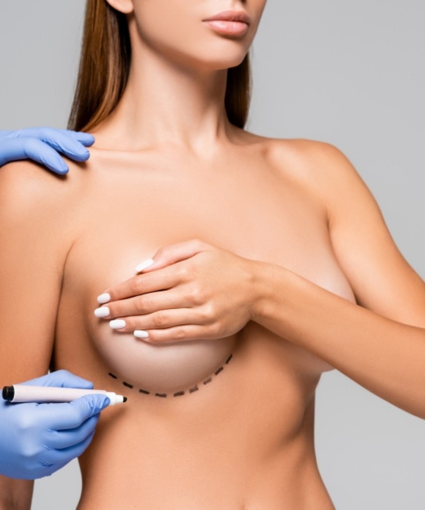 breast implant