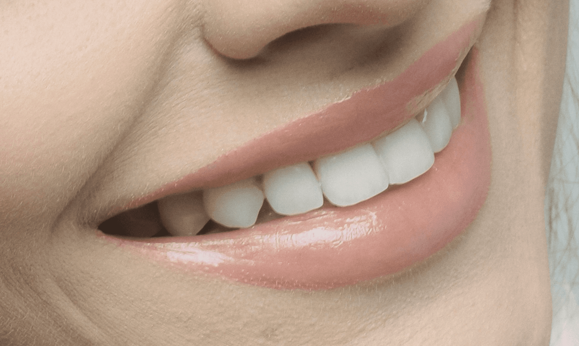 Greencare Teeth Whitening