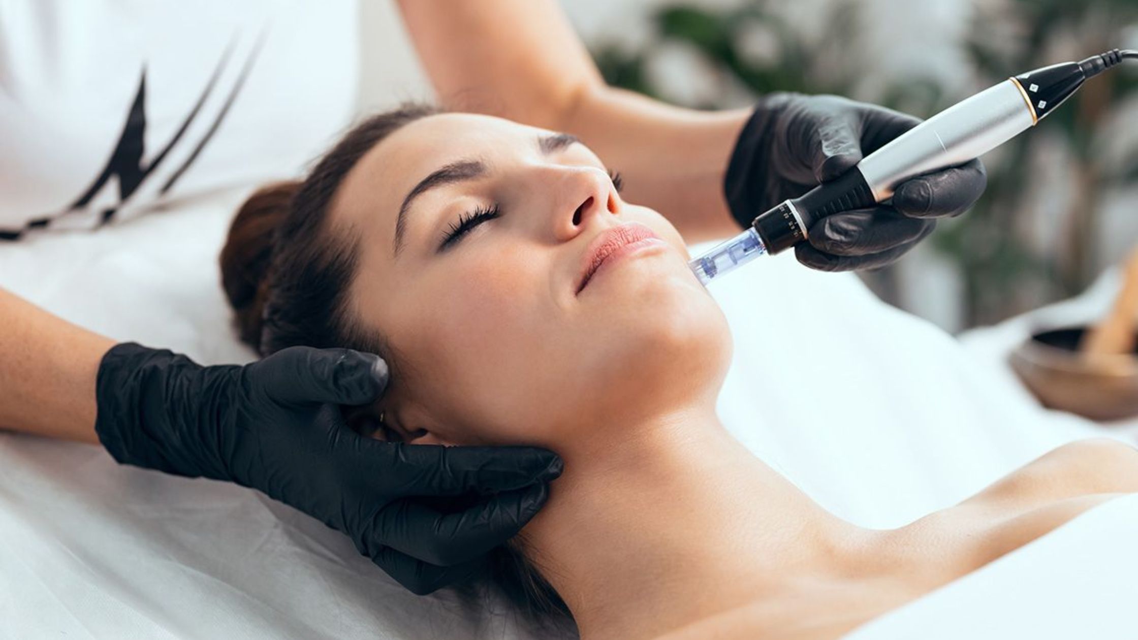 Microneedling in Frisco what to expect