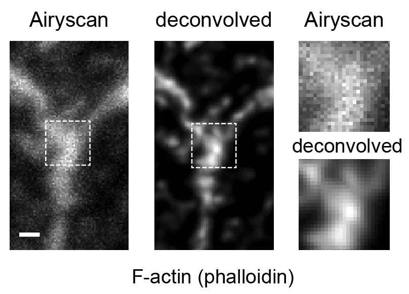 Super-resolution microscopy image placeholder one