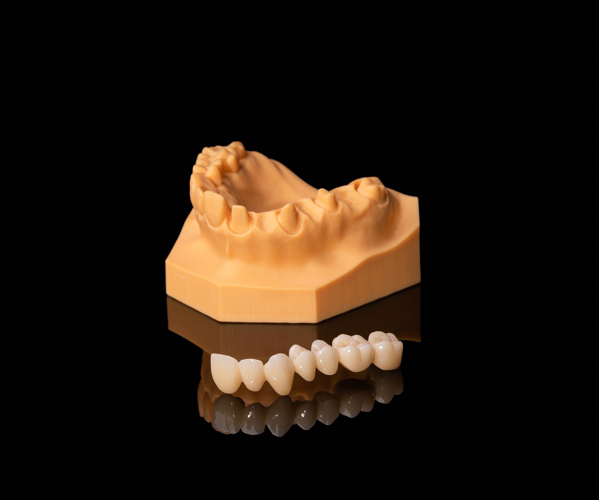 Fixed Restorations