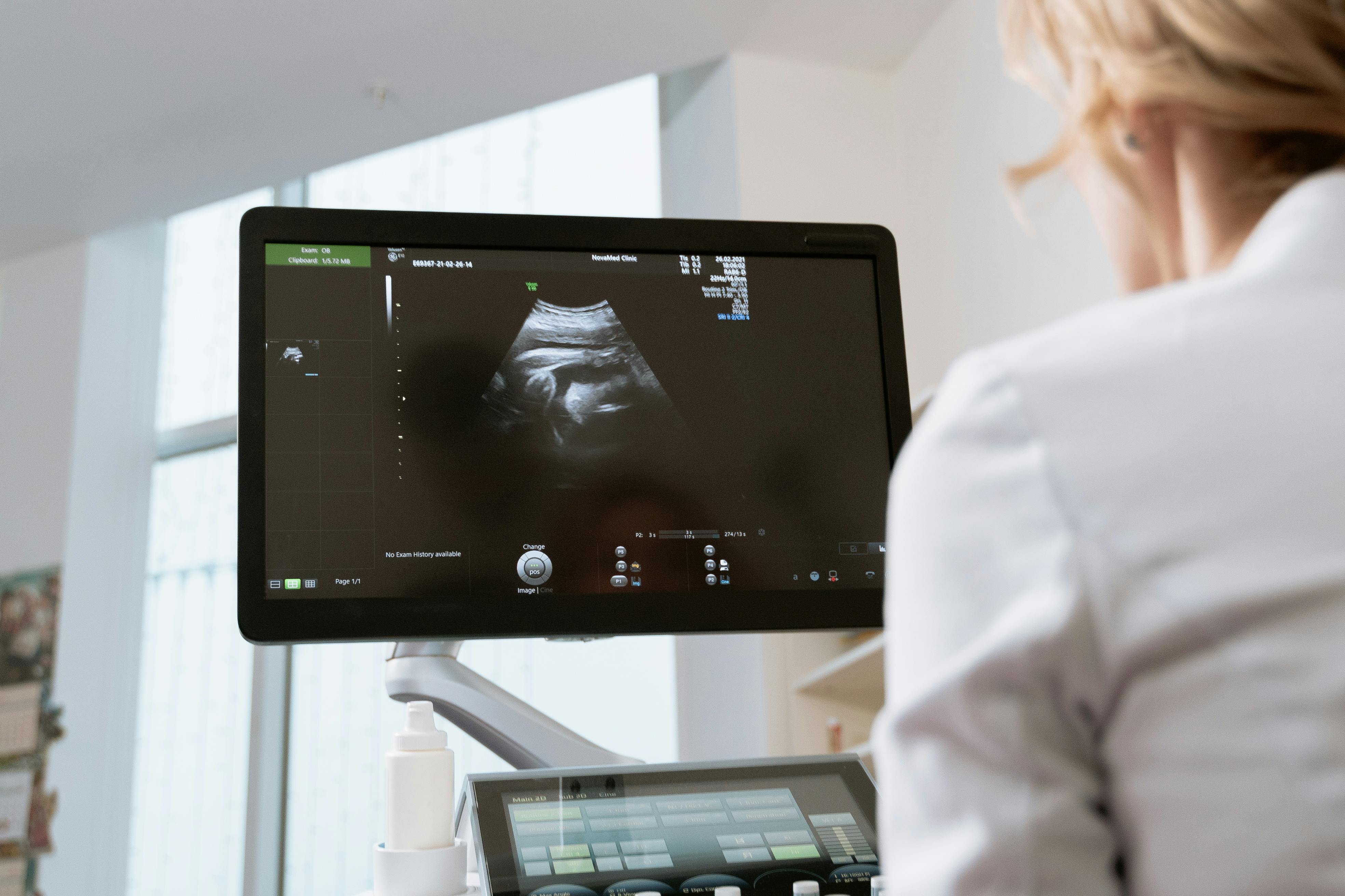 Ultrasound scan setting, female patient with doctor, respectful framing, no exposed body details, warm clinical lighting.