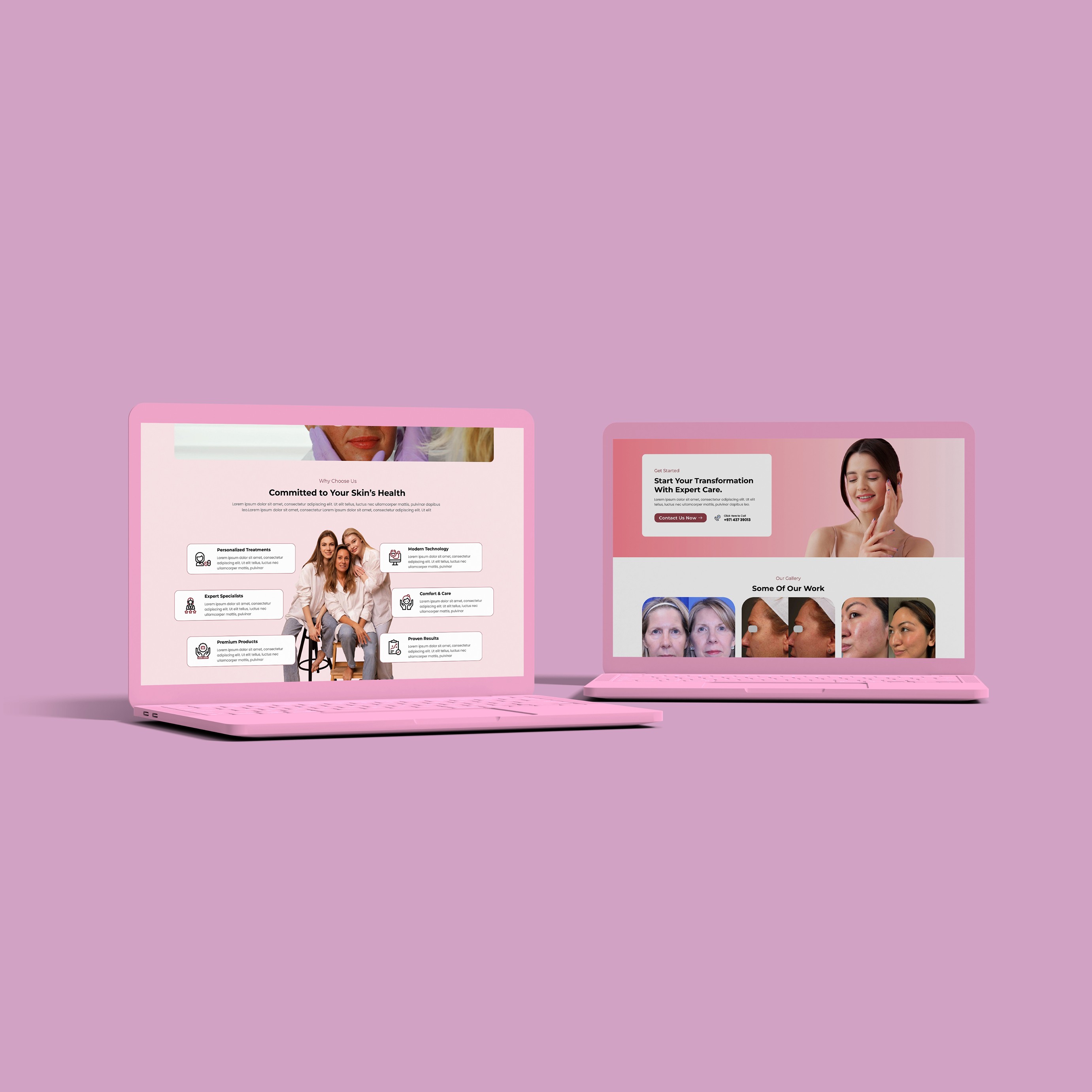 Showcase image
