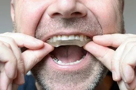 Teeth Grinding