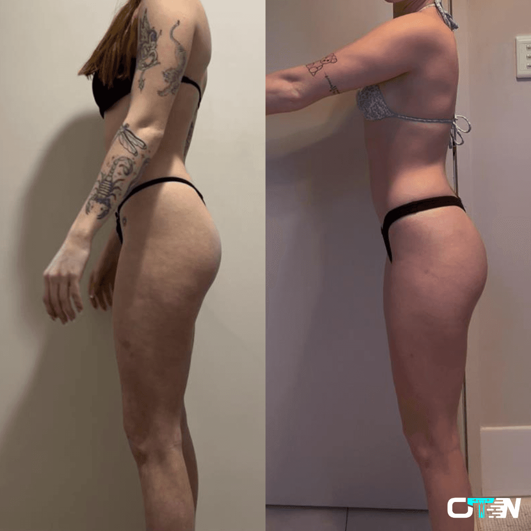 Transformation Photo