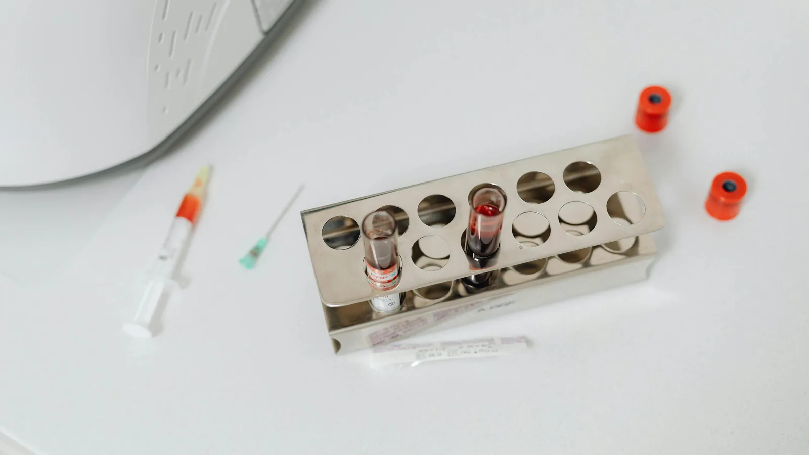 What Is MCV on a Blood Test?