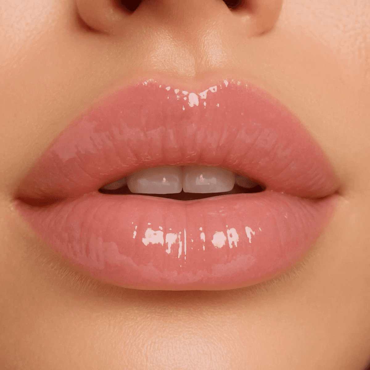 Aumento de Labios en Terrasa, Heaven Clinics