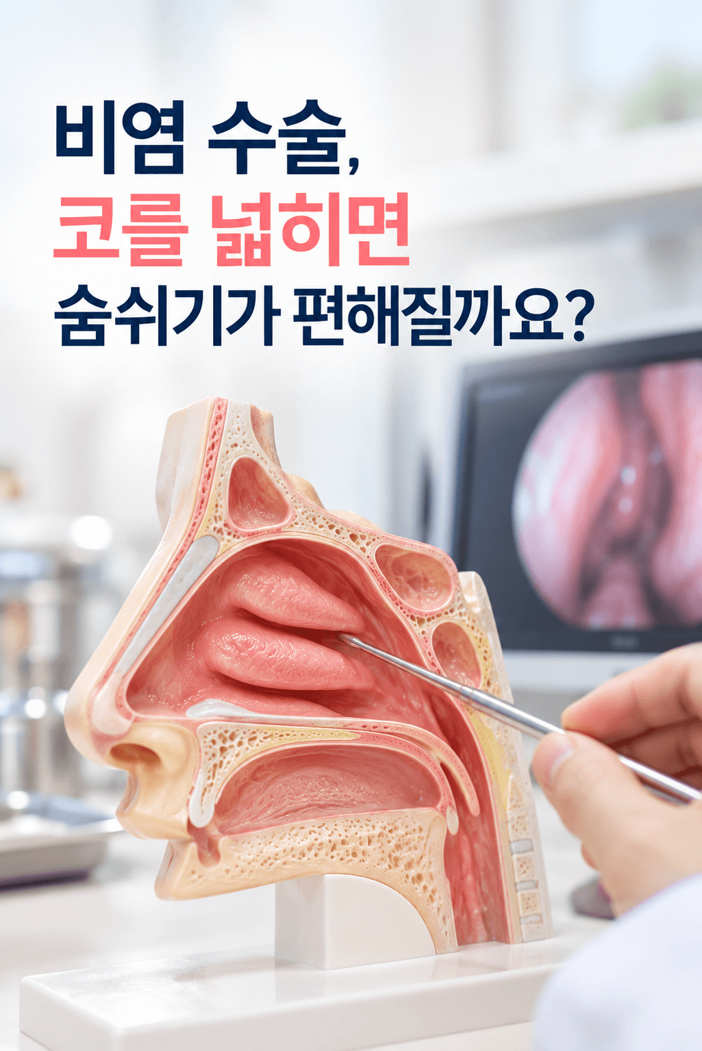비염 수술과 코막힘 개선을 주제로, 비갑개의 구조와 기능을 설명하는 코 내부 모형 및 태후한의원 코숨길 건강정보