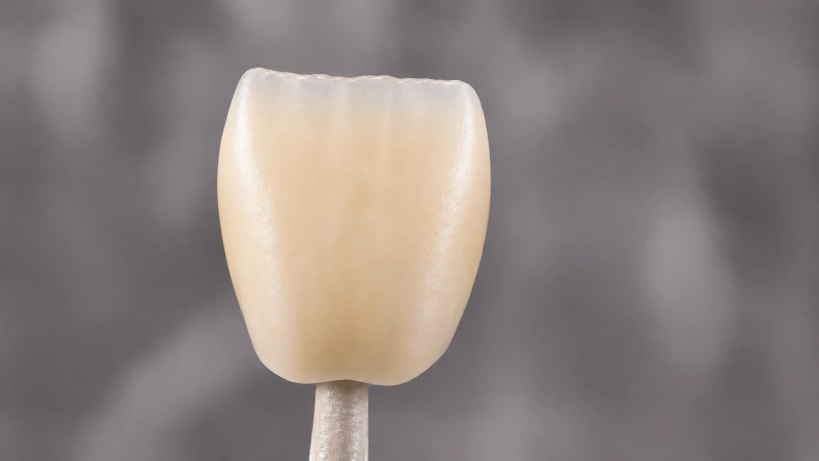 Corona anterior con superficie seca antes del glaseado