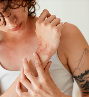 When to see a dermatologist