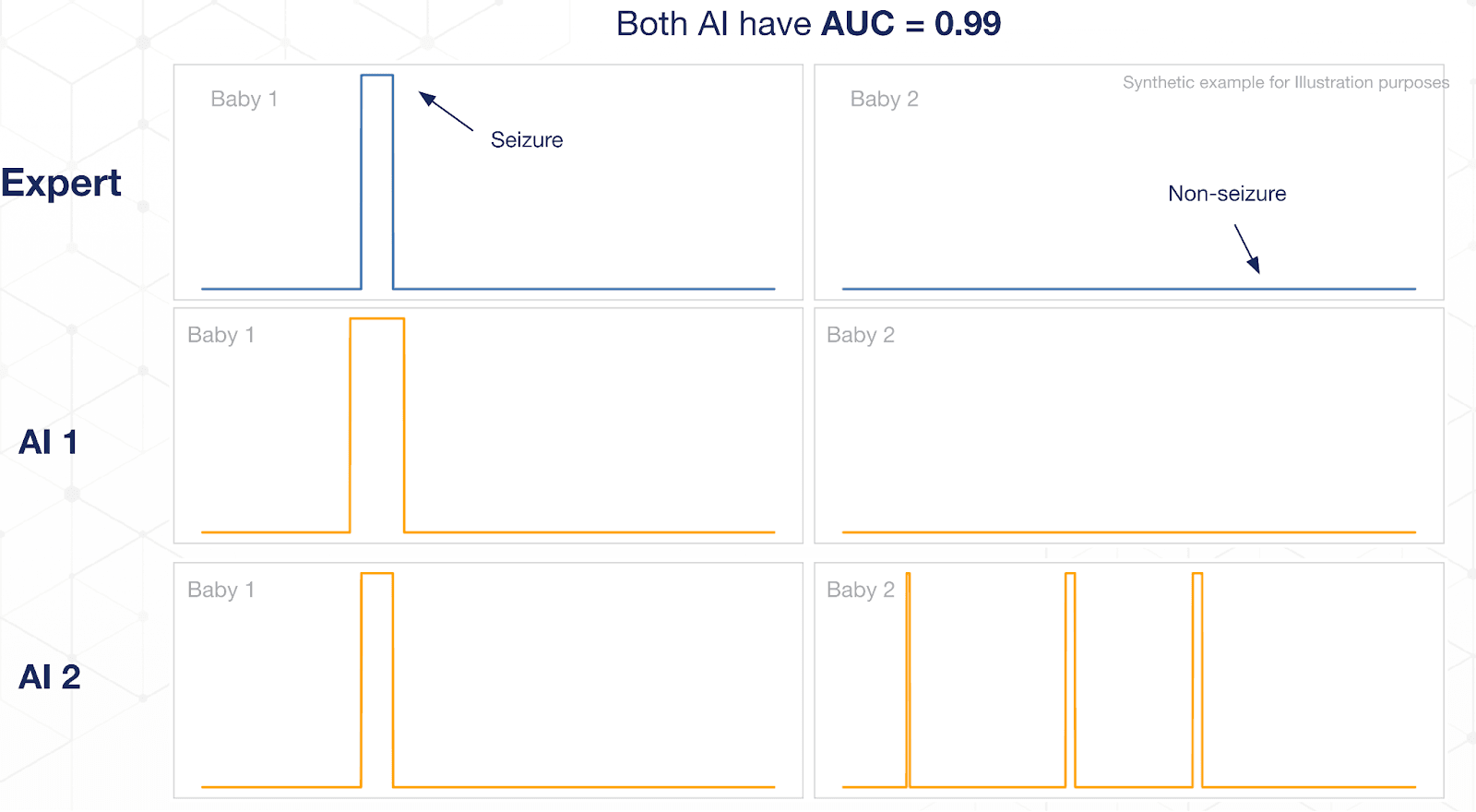 graphic of expert human versus AI seizure detection