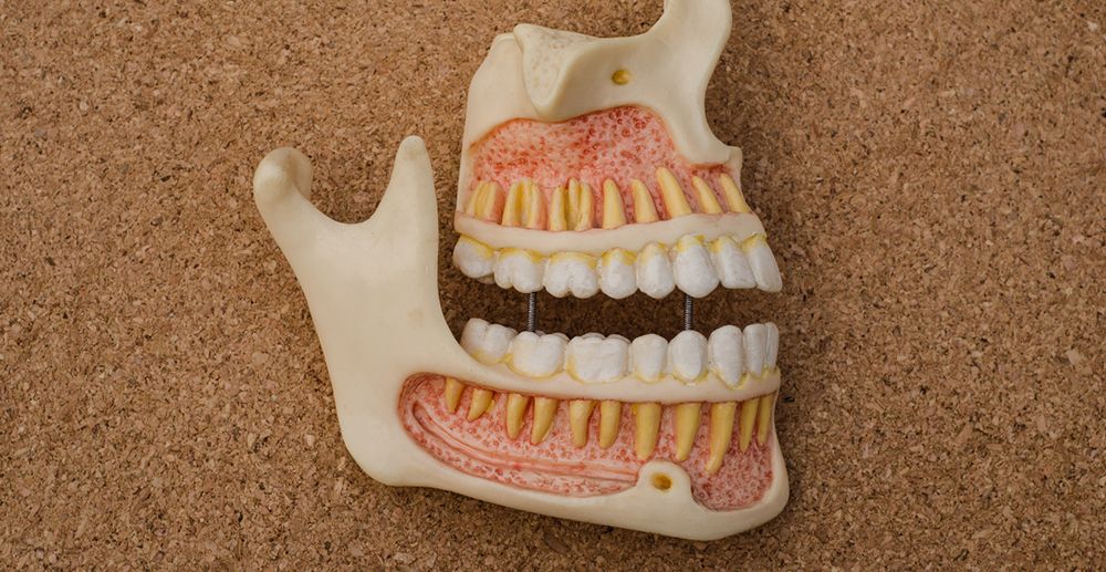 Maxilar superior e maxilar superior