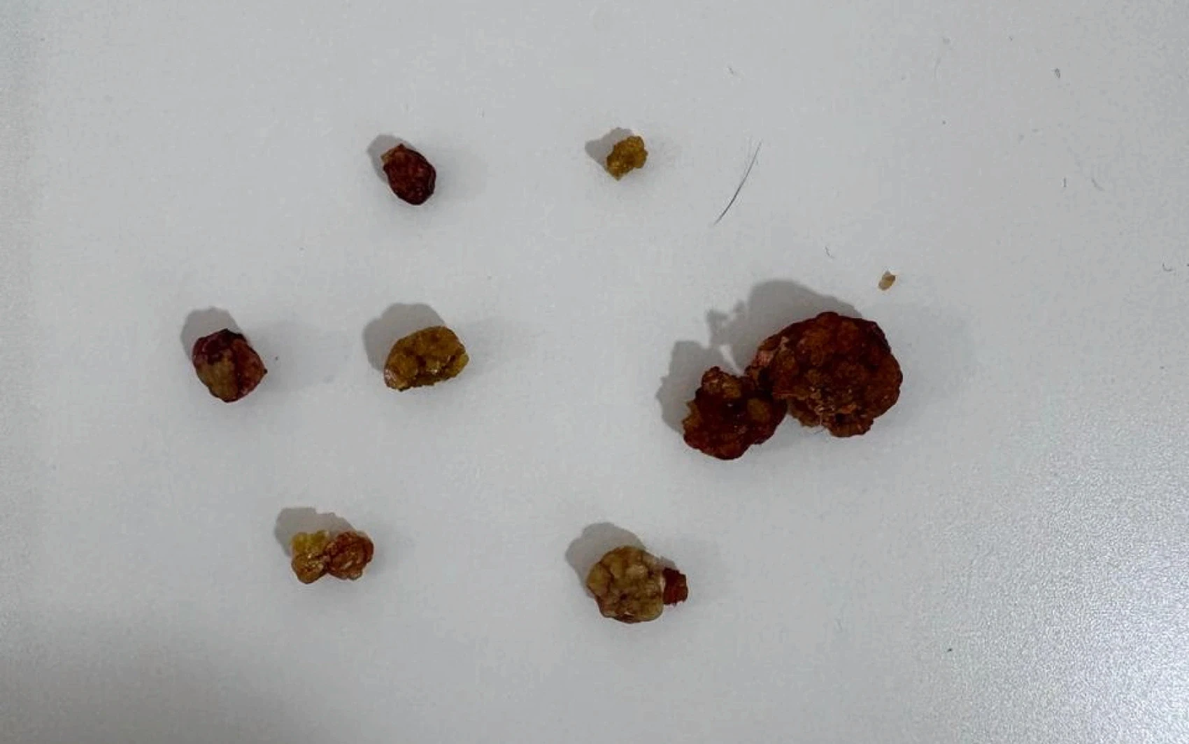 A collection of small, unevenly shaped, dark brown and yellowish stones scattered on a white surface, casting soft shadows and suggesting a textured, rugged appearance.