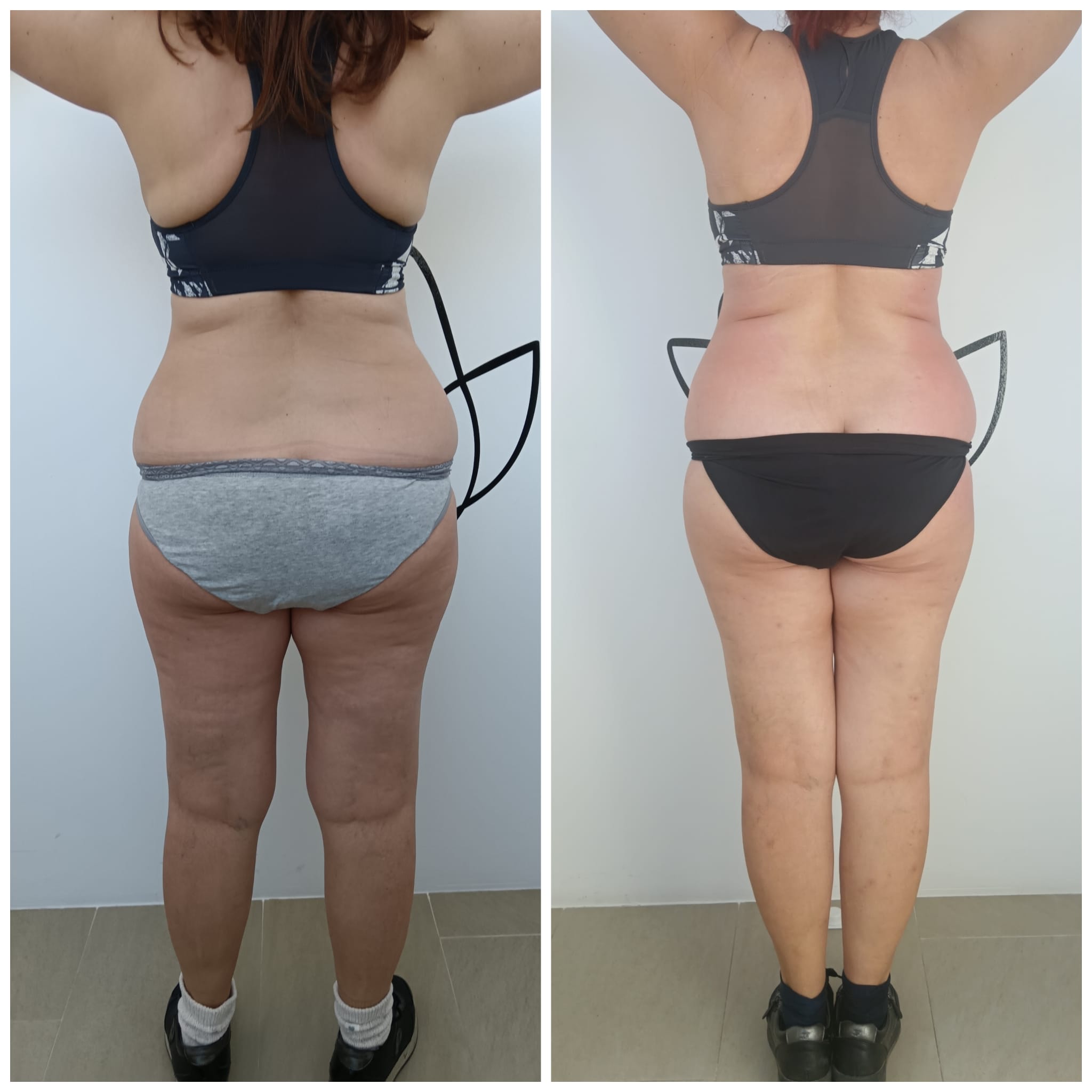 Transformation Photo