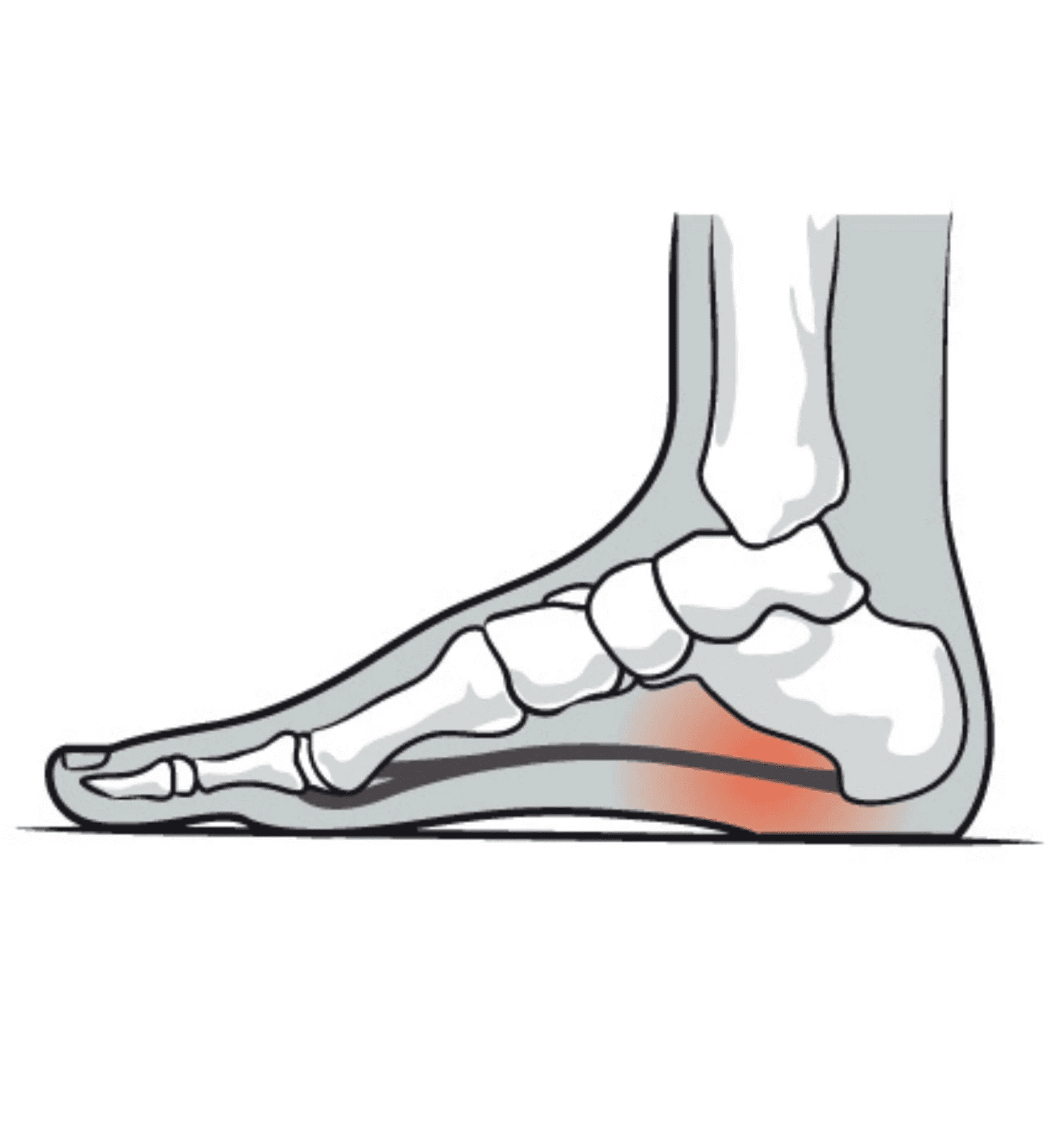 Image showing source of pain for – What is it? And how we can help treat you