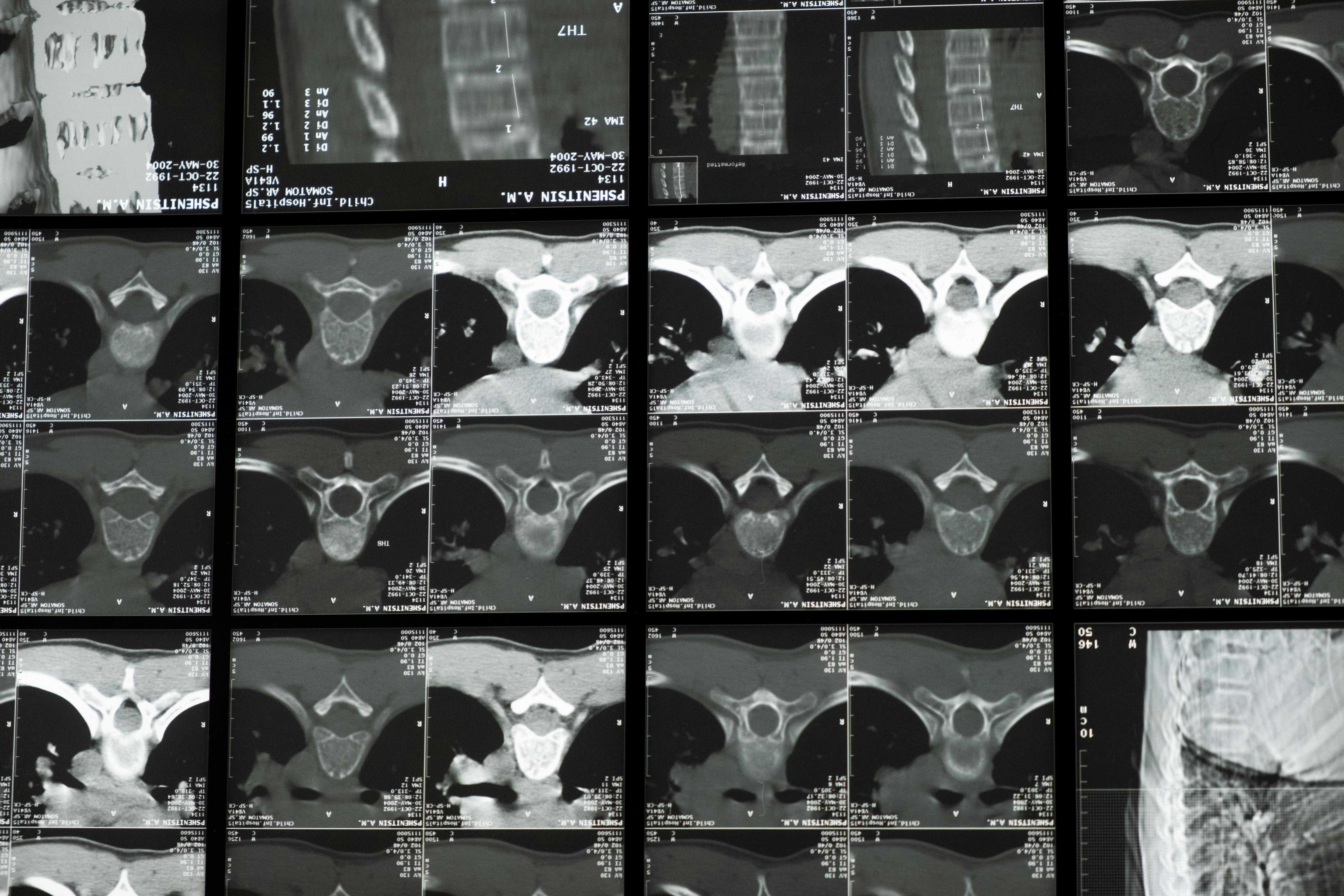 Spinal images