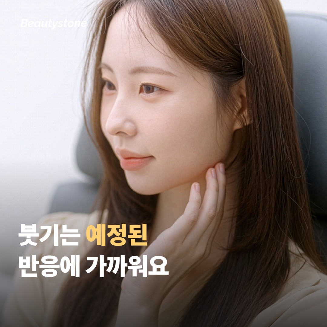 DCA 주사 붓기와 지방 감소, 시간표가 다른 이유