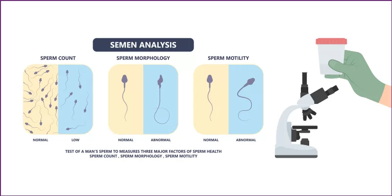 Semen analysis overview