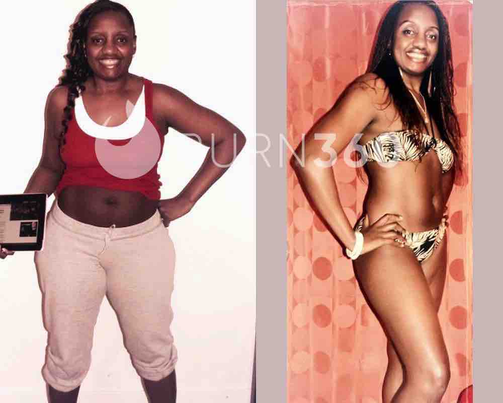 Tsitsi's before and after photos (front)