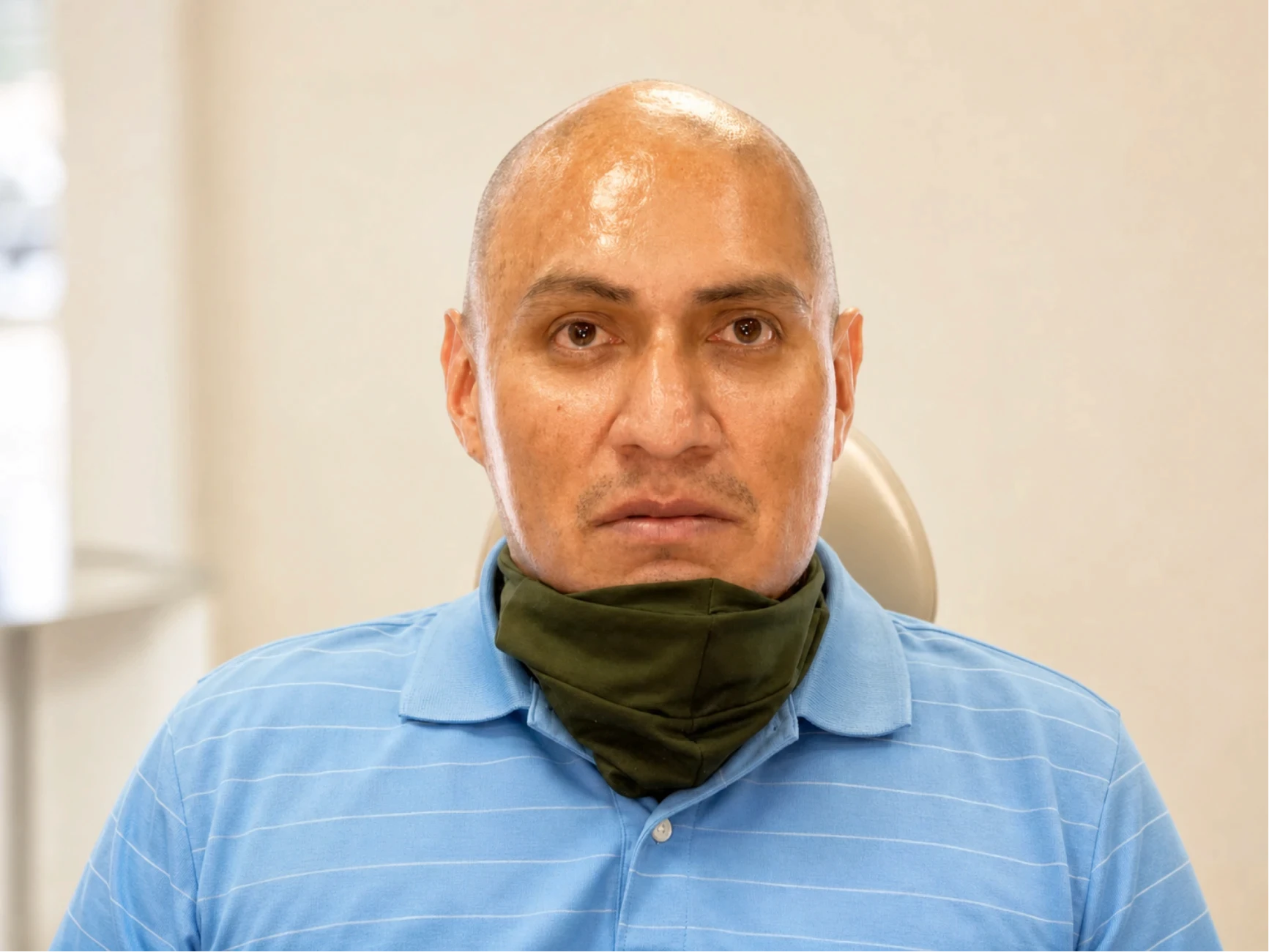Patient 2 before full-arch dental implant treatment at lleveza