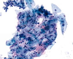 A blue and purple blob
Description automatically generated