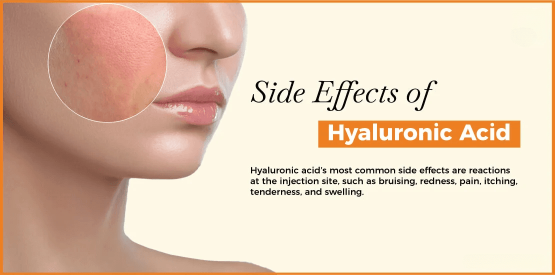 What Are the Cons of Hyaluronic Acid Injections?