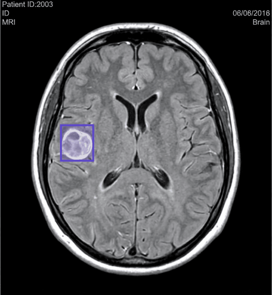 AI for Scanner Images