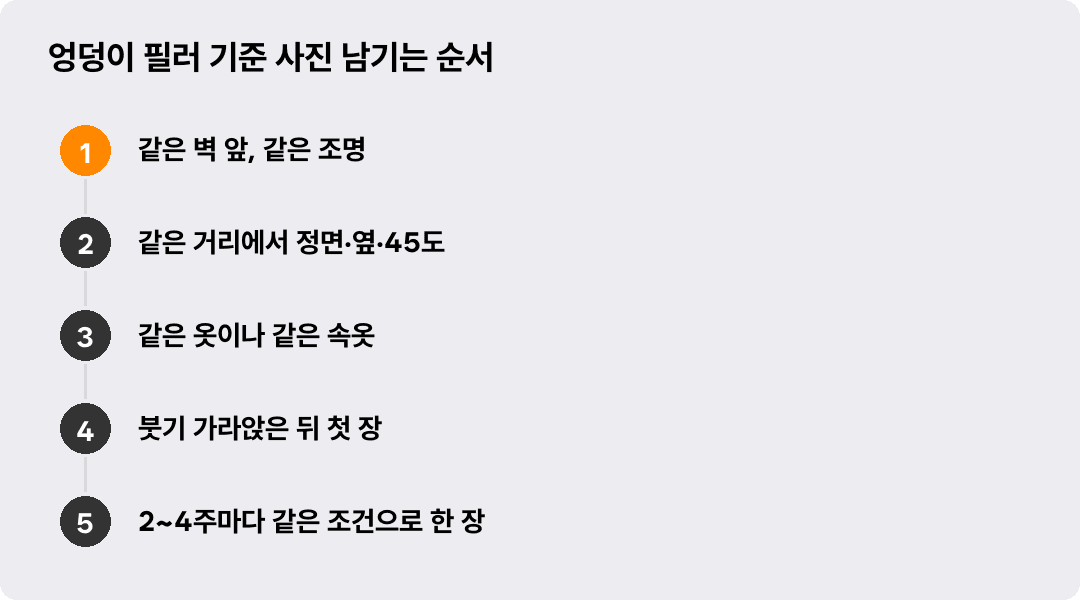 엉덩이 필러 기준 사진 남기는 순서