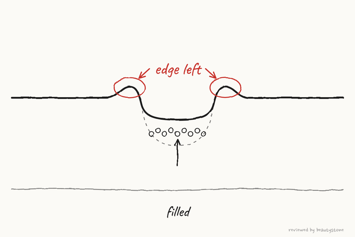 Pen drawing of a cross-section where the floor is filled but a raised edge remains at the rim