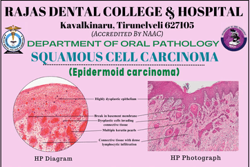 Oral cancer image