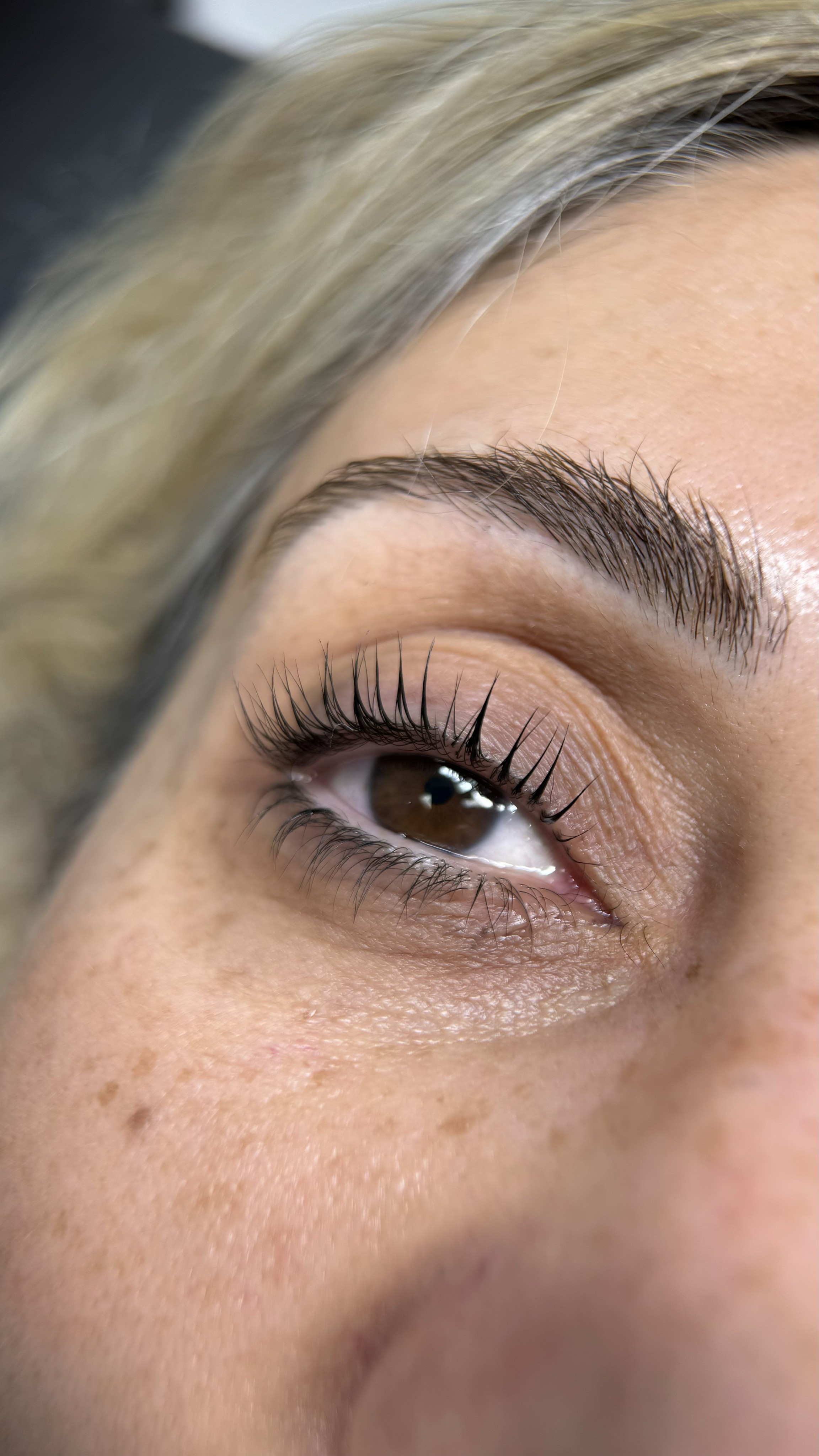 Crop view of an eye, after the procedure