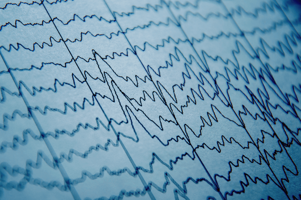 EEG waves on printed page