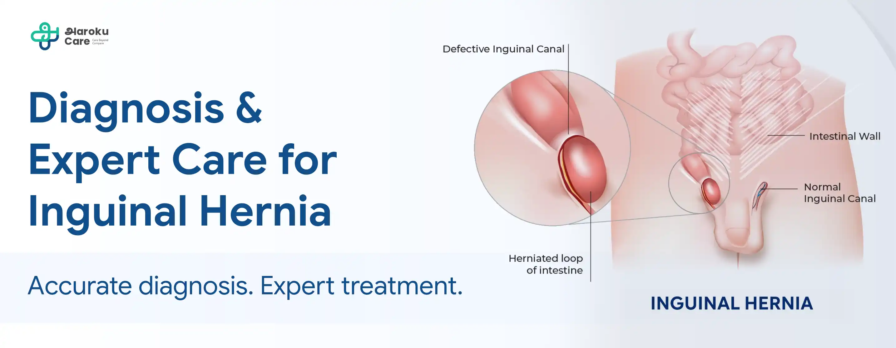 Diagnosis & Expert Care for Anal Abscess