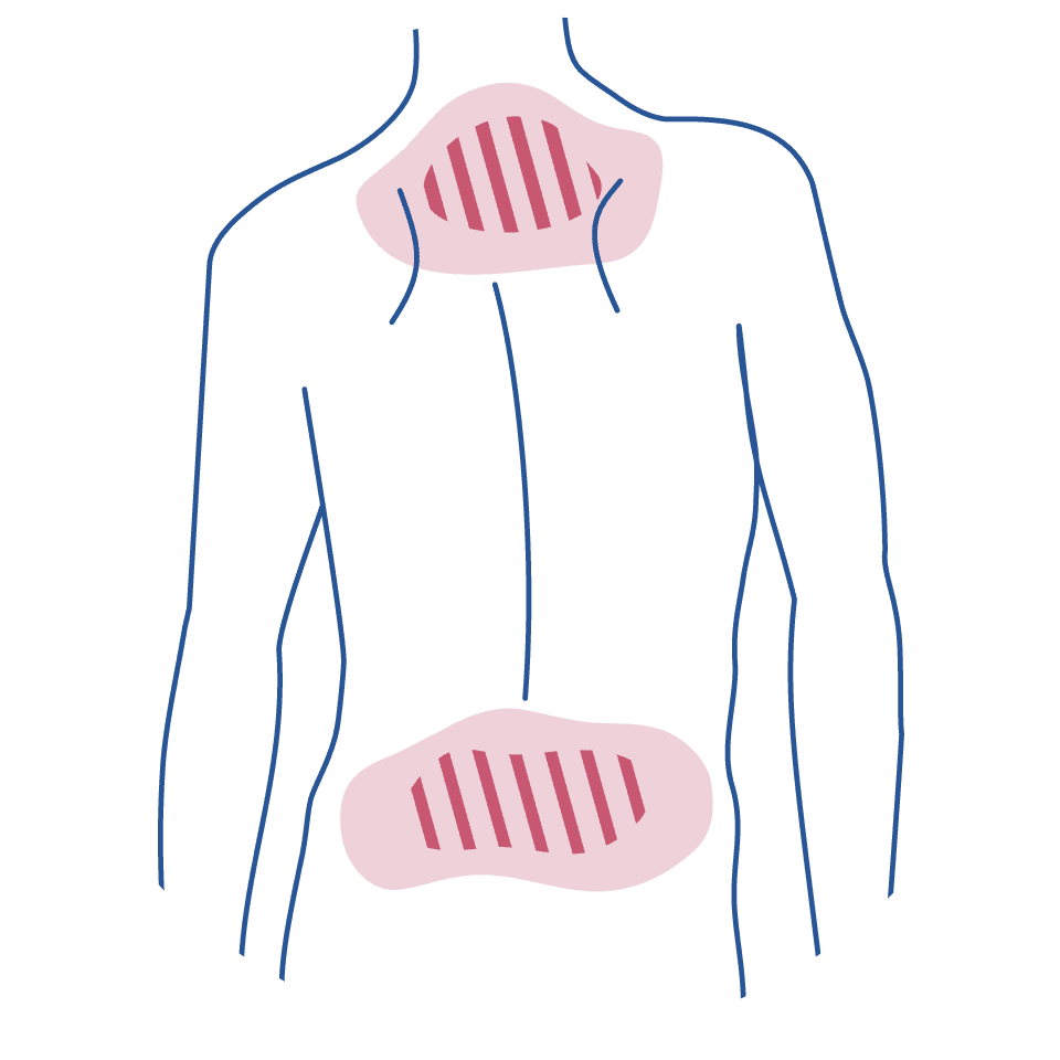 Desenho de um homem de costas em linhas azuis, com uma região demarcada com linhas rosas apontando a região de dor lombar e cervical.
