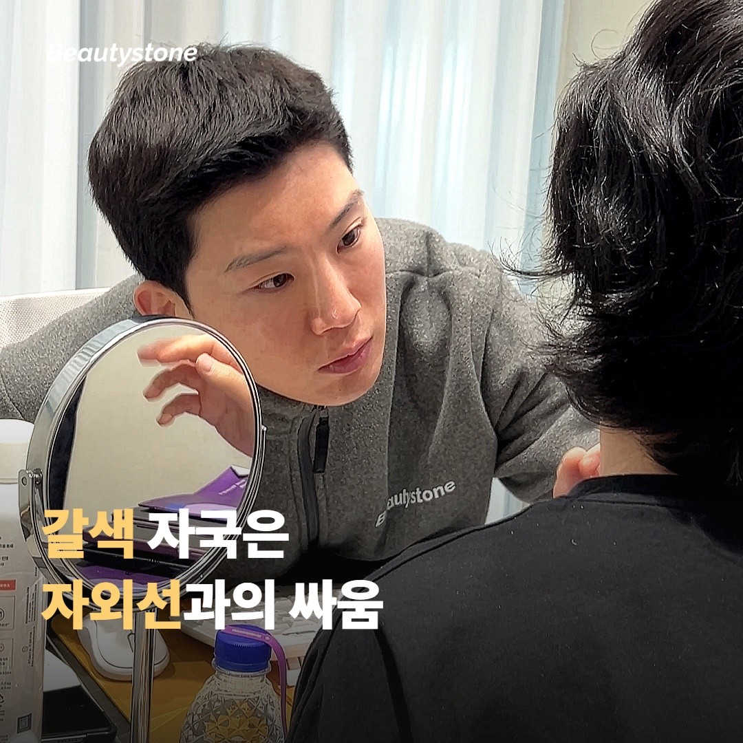 갈색 자국(PIH)은 자외선과의 싸움이에요