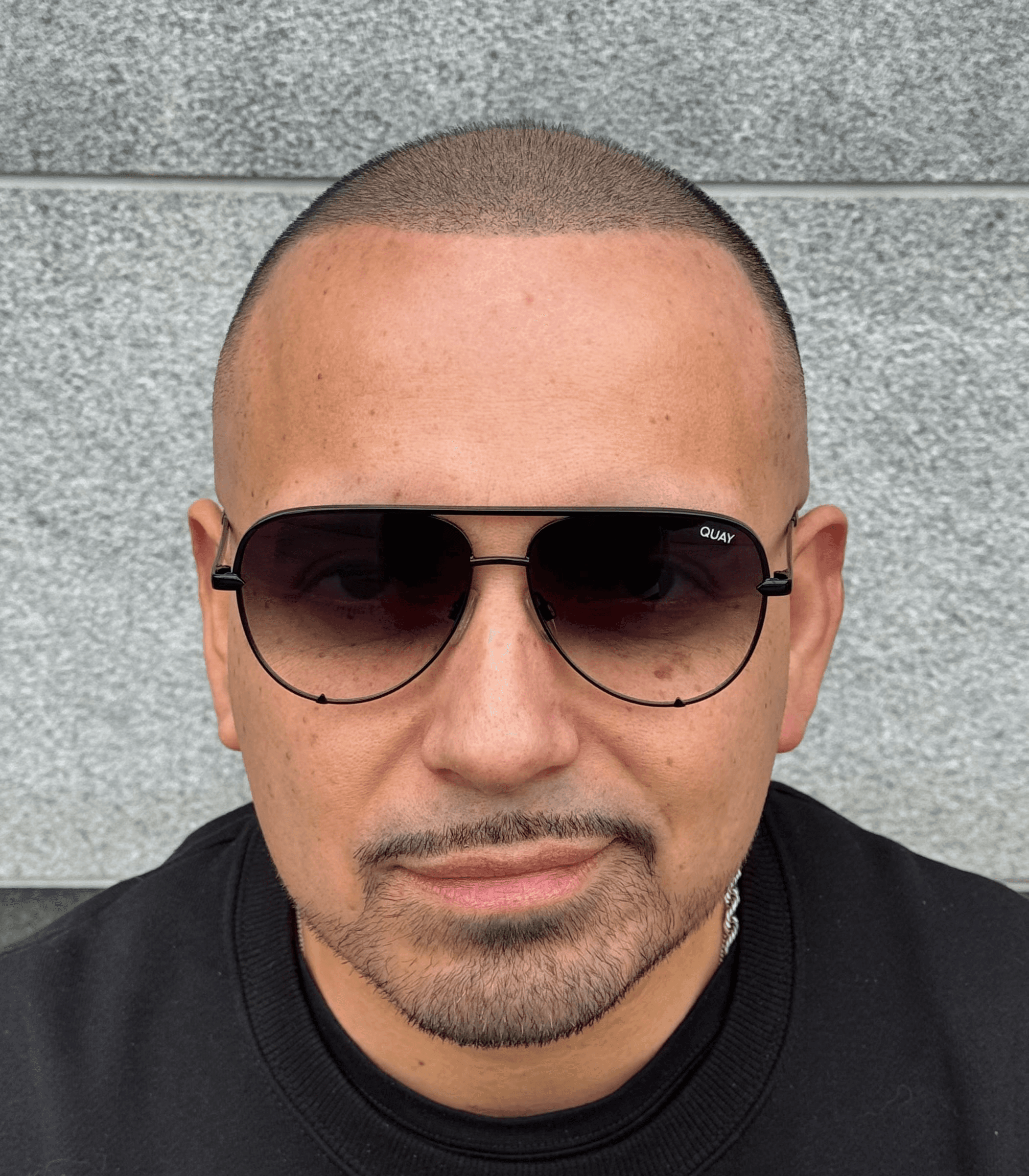 Scalp & Brows, Skalp Mikropigmentering i Stockholm