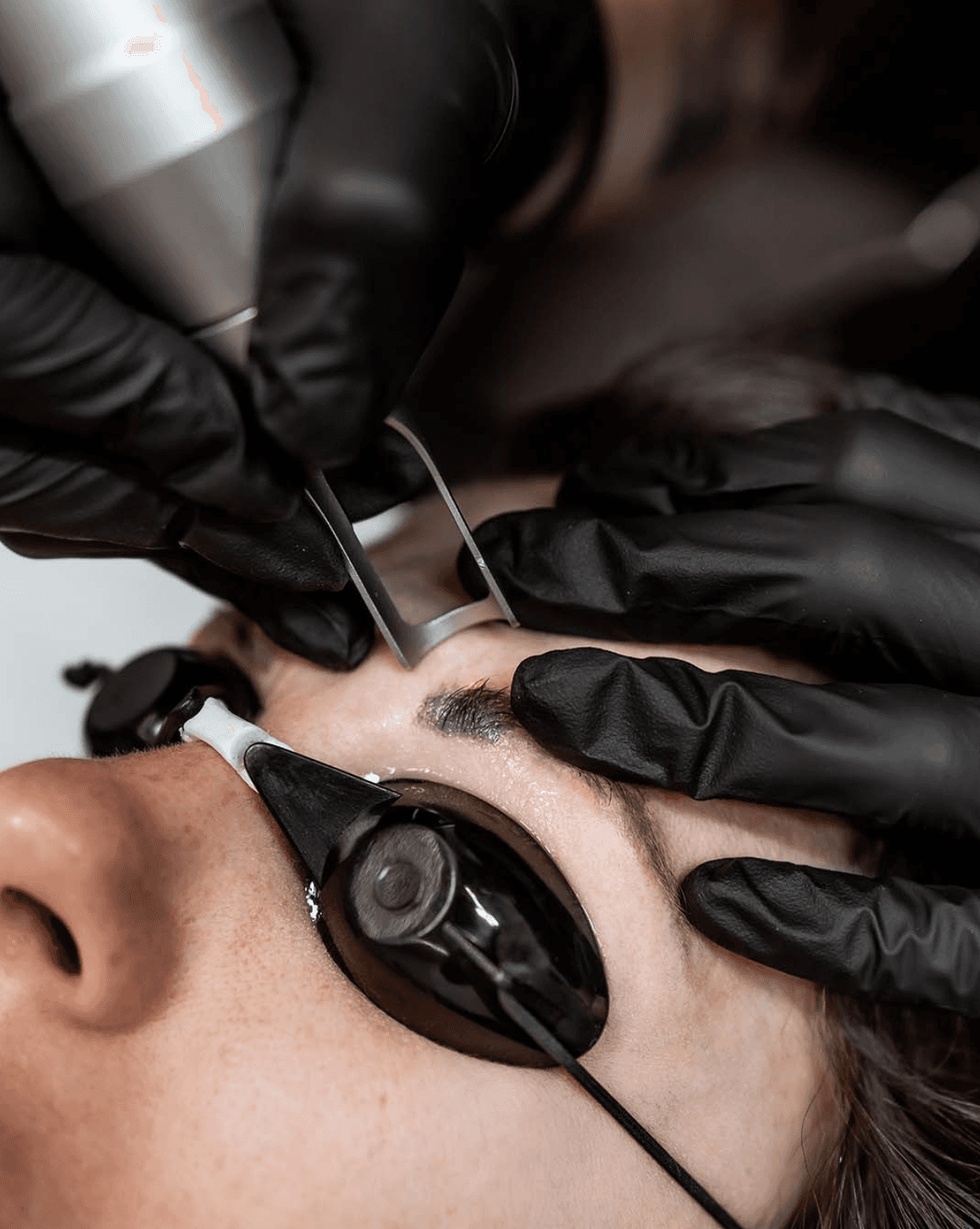 PMU & Microblading entfernen