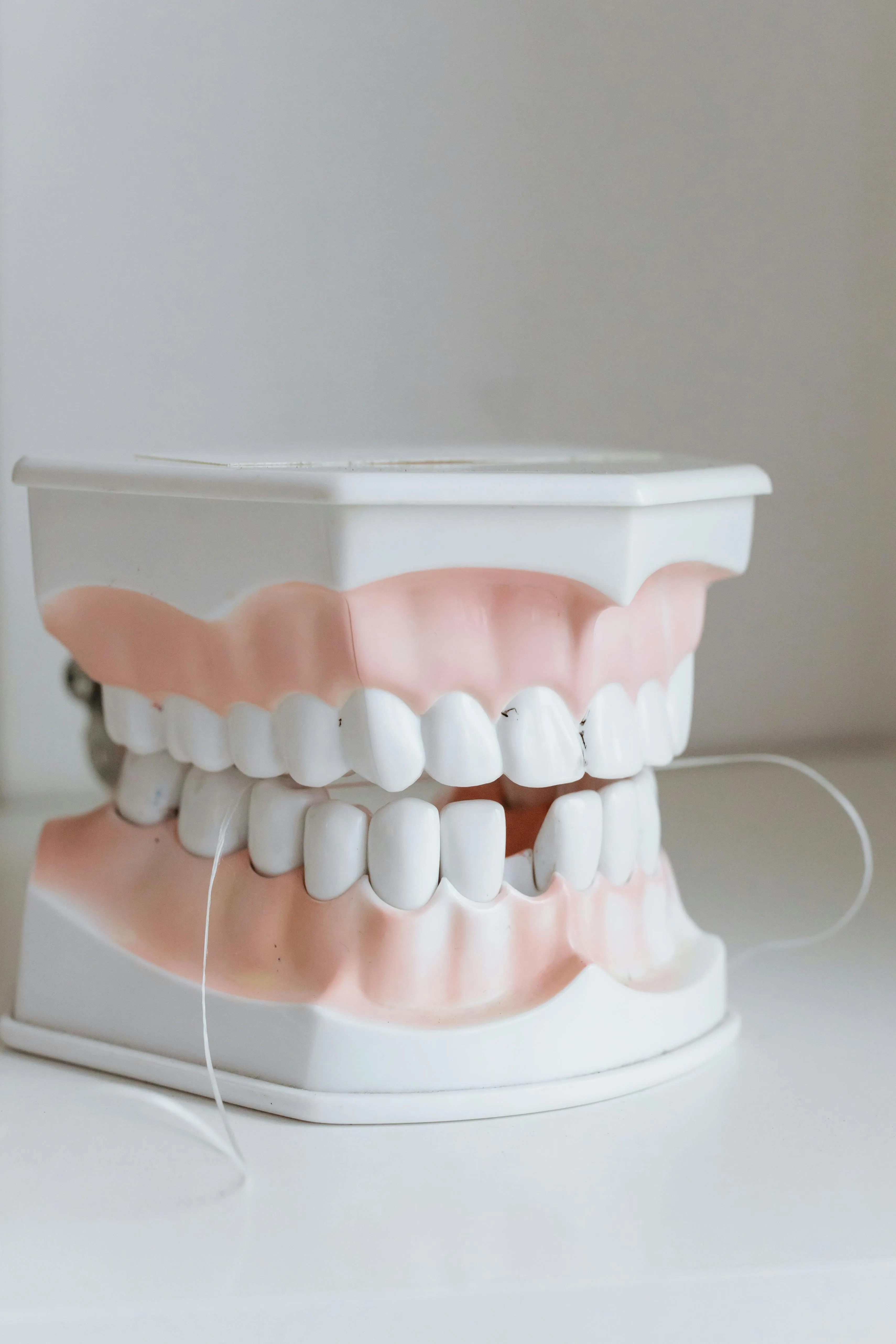 A picture of a model of teeth with one tooth extracted after dental extraction at Midtown Dental Studio on Eglinton in Midtown Toronto, Ontario | Best Dentist in Midtown Toronto, Ontario