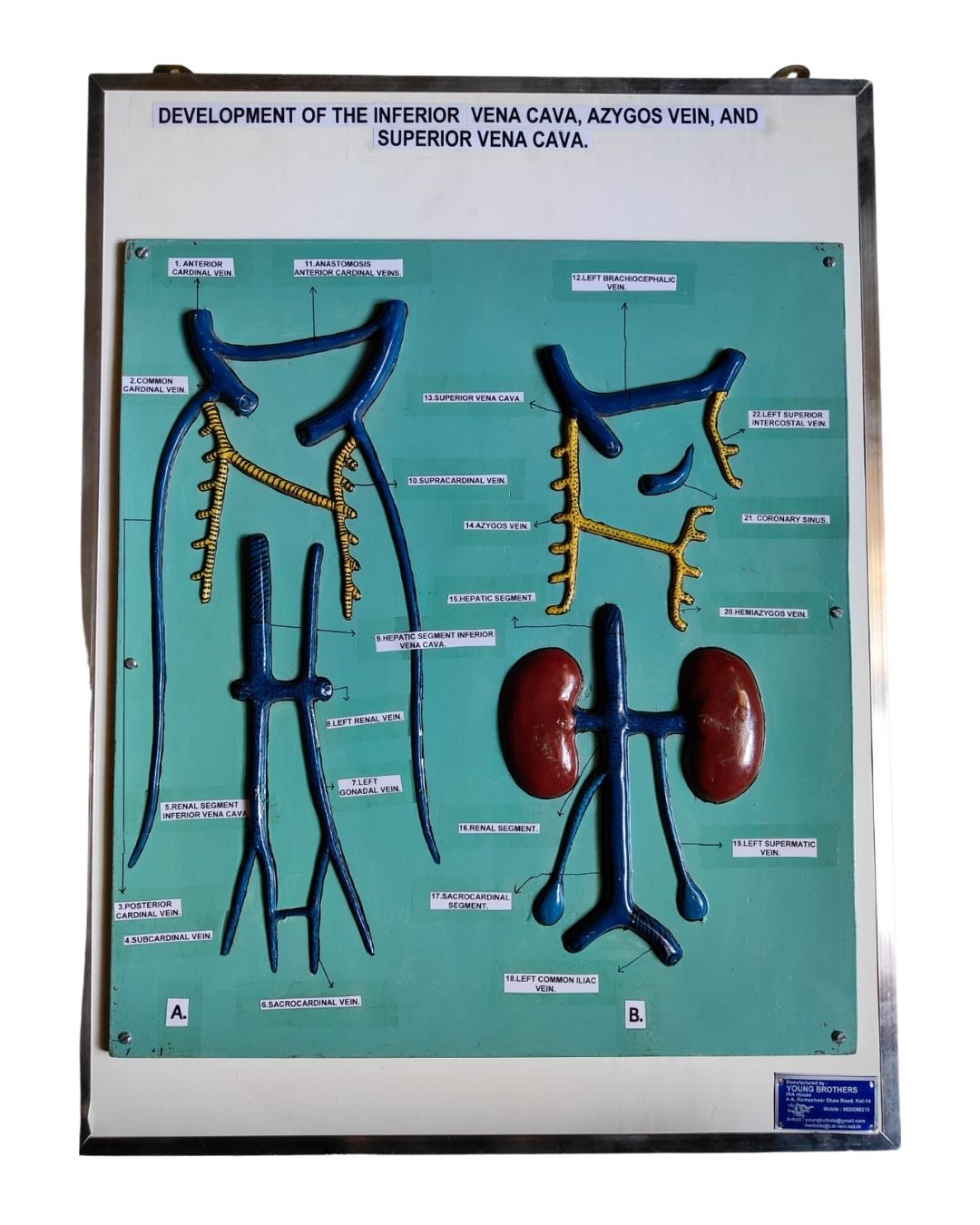 Development of the Inferior Vena Cava, Azygos Vein, and Superior Vena Cava