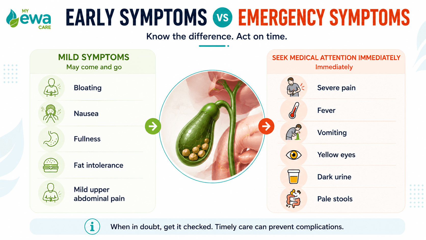 Early Symptoms of Gallbladder Stones