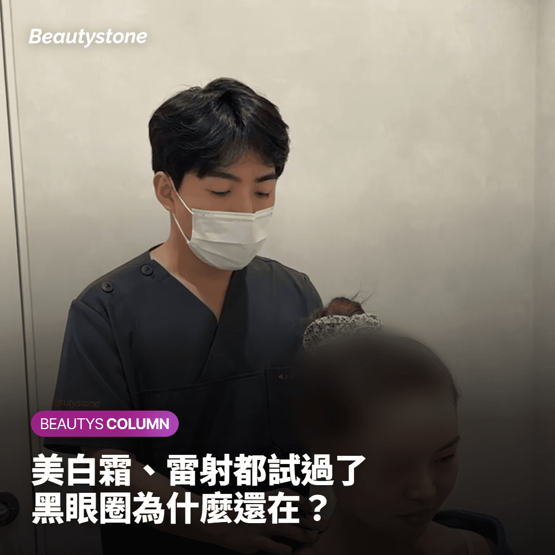 [對比分析]色素雷射vs血管雷射——按黑眼圈型別定製的治療公式