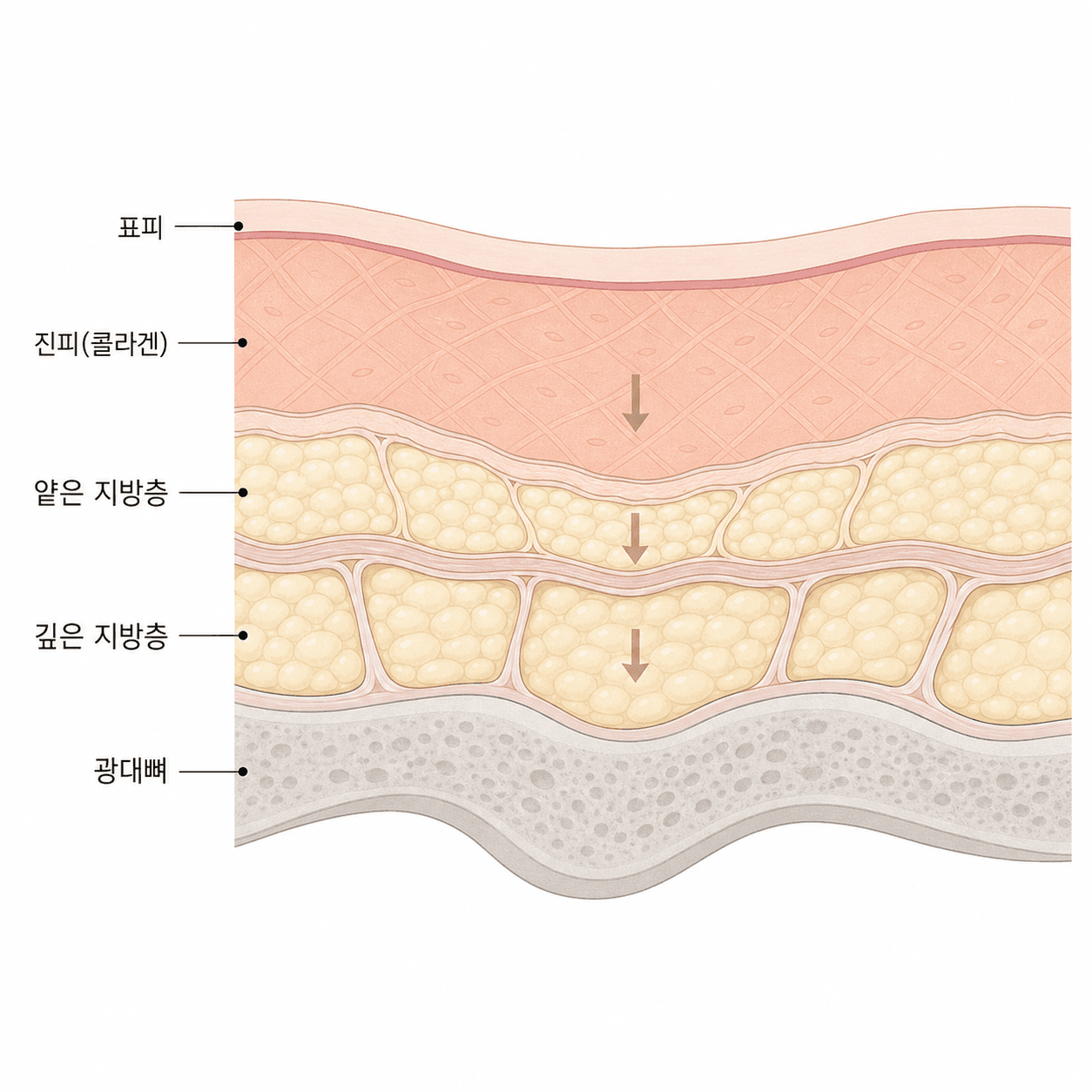 중안면 지방층 구조와 나이에 따른 볼륨 소실