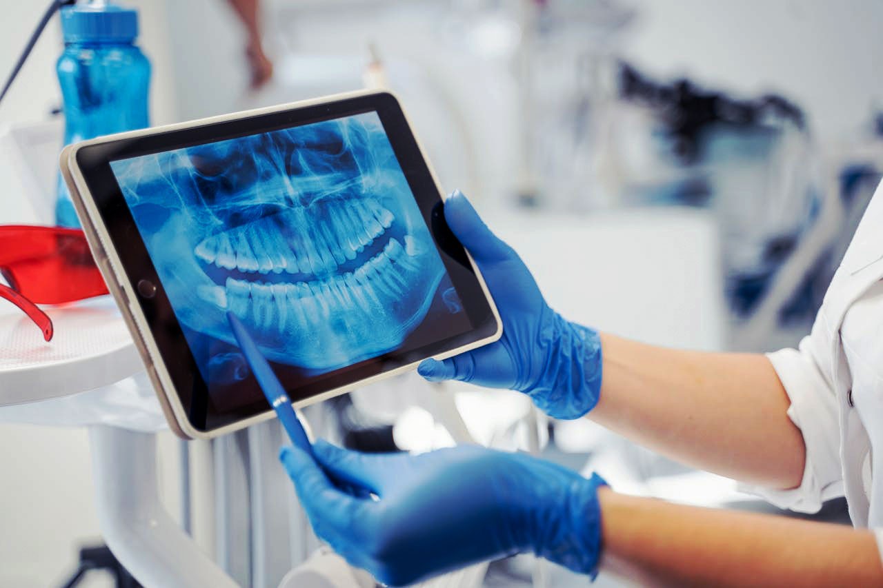 Doctor holding a tablet showing an x-ray to a mouth.